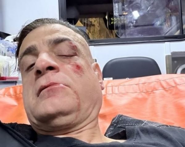 Cicalone, il popolare youtuber, aggredito da borseggiatori alla fermata Ottaviano